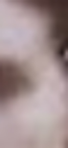 19740959