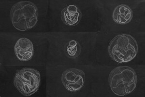 MATTHEW SWARTS MYSTERY SCHOOL FETAL DAWINGS PENNSYLVANIA 2000