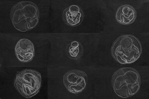 MATTHEW SWARTS MYSTERY SCHOOL FETAL DAWINGS PENNSYLVANIA 2000
