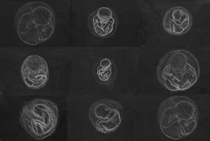 MATTHEW SWARTS MYSTERY SCHOOL FETAL DAWINGS PENNSYLVANIA 2000