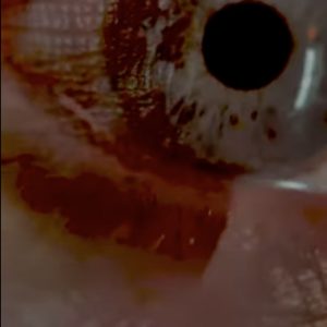 MATTHEW SWARTS EYEPRINT