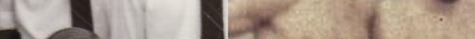 MATTHEW SWARTS A close-up, cropped image with part of a white garment or coat on the left, a visible button, and bare skin on the right. The blurred composition and partial objects lend a contemporary art feel to this fine art photography piece.